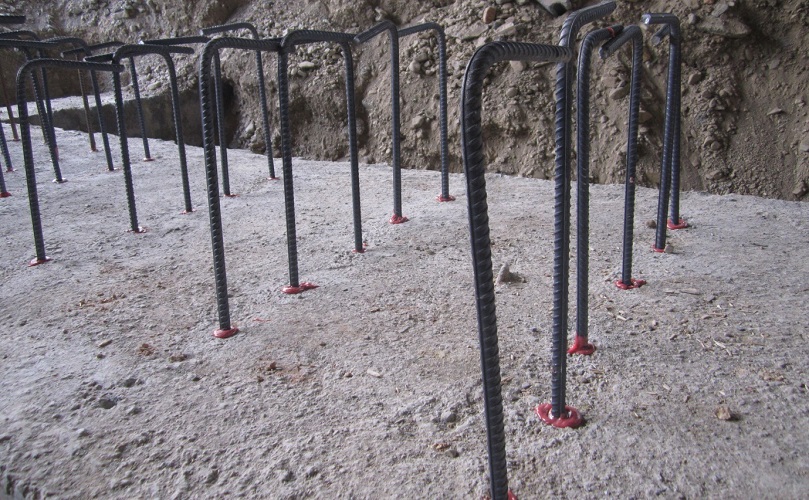 بهترین شرکت کاشت بولت در تهران - ساختمونی نیوز